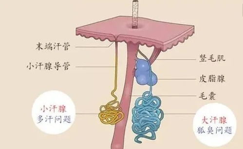 有狐臭怎么解决 再也不用担心夏天近距离接触了